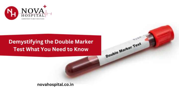 Demystifying the Double Marker Test What You Need to Know