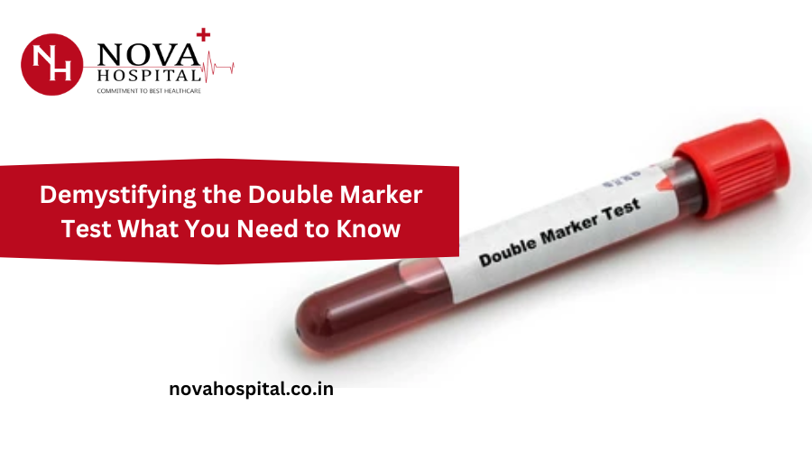 Demystifying the Double Marker Test What You Need to Know