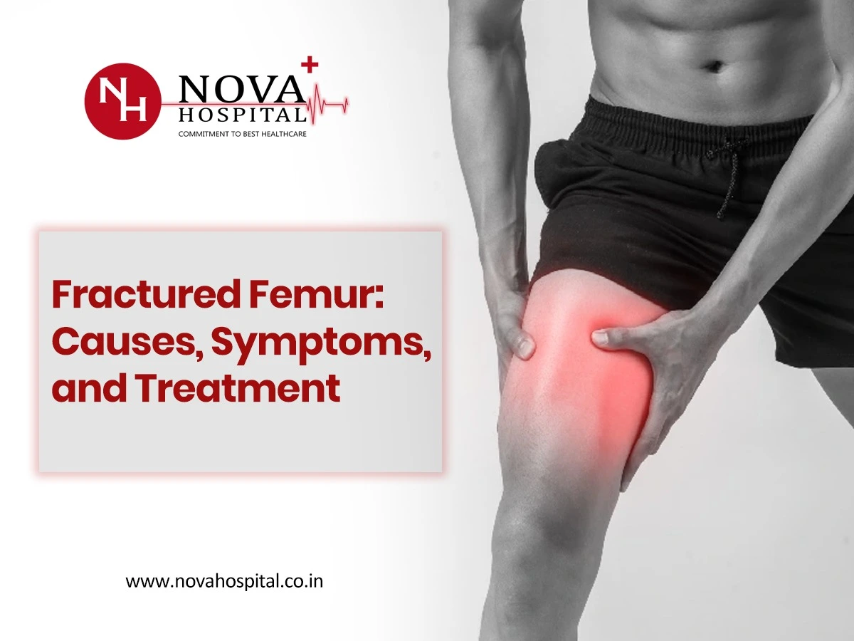Fractured Femur: Causes, Symptoms, and Treatment